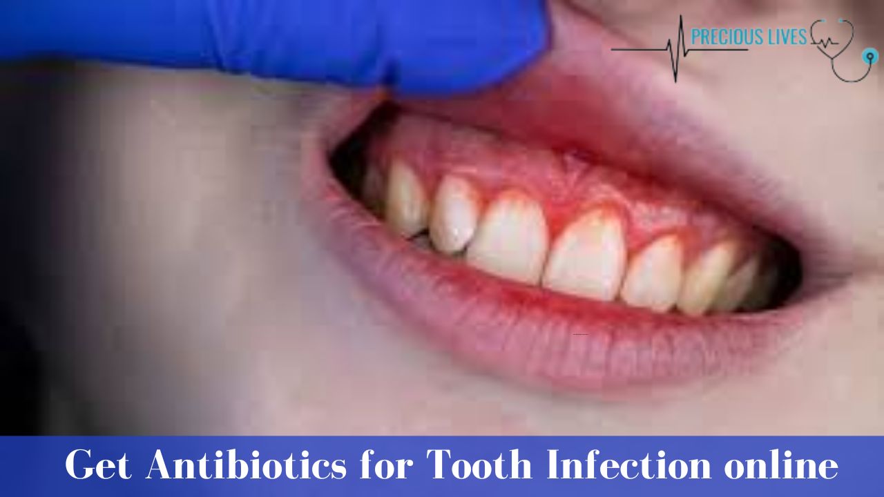 Get Antibiotics for Tooth Infection Online